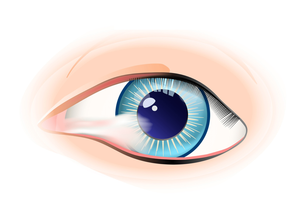 Pterygium eye min