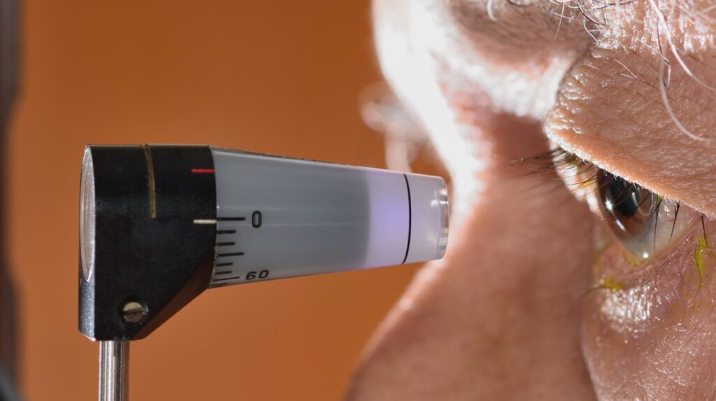 Diabetes and Glaucoma min