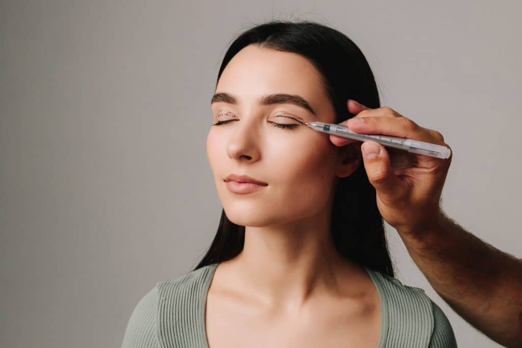 Surgeon marking a patient's eyelid in preparation for upper blepharoplasty surgery to ensure accurate and precise results