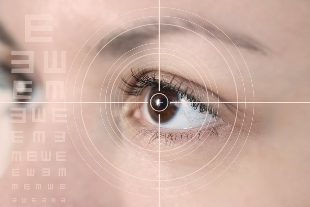 Close-up of female amber eye with digital overlay illustrating eye laser surgery concept for vision correction.